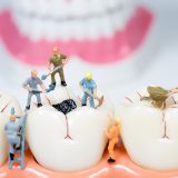 Zubný kaz môže bolieť, ale aj nemusí